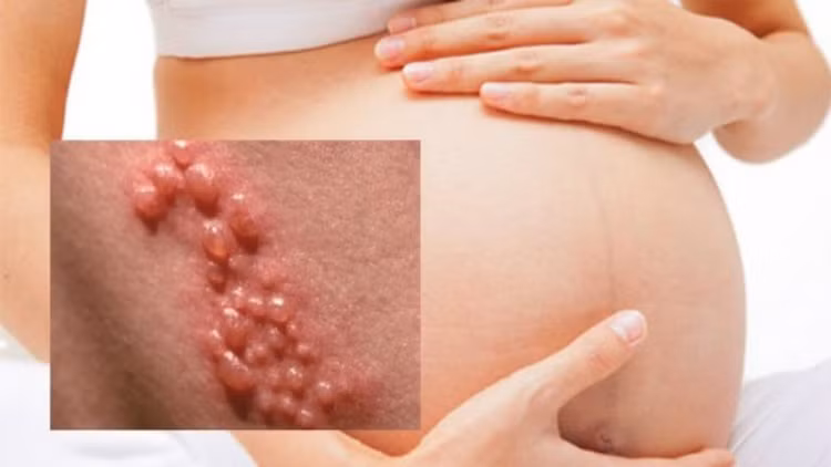 Bệnh lậu ảnh hưởng đến thai nhi như thế nào?