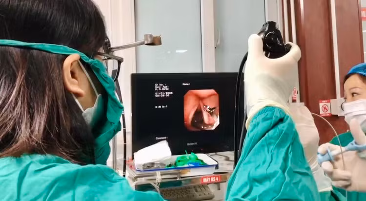 Nội soi phát hiện vắt trong lòng khí quản bệnh nhân Nội soi phát hiện vắt trong lòng khí quản bệnh nhân