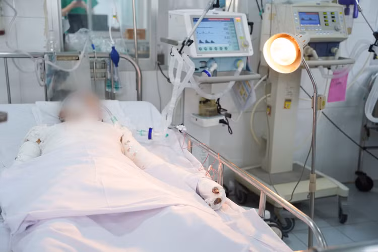 Bệnh nhân bị pháo nổ đa chấn thương và phỏng nghiêm trọng - Ảnh BVCC