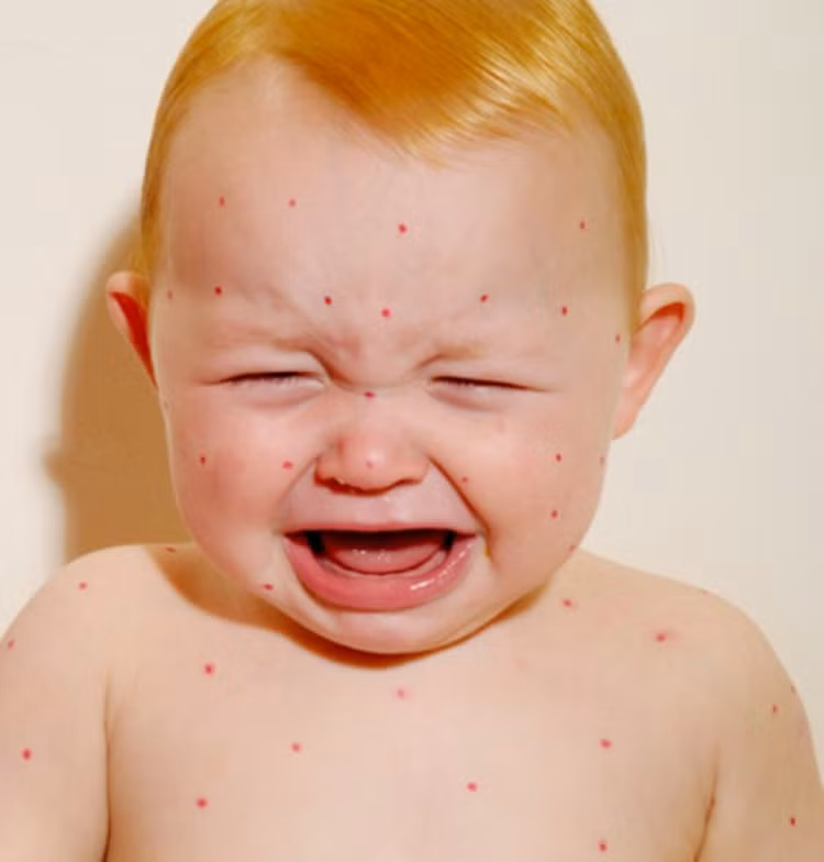 Mắt đỏ và nhạy cảm với ánh sáng mặt trời Mắt đỏ và nhạy cảm với ánh sáng mặt trời