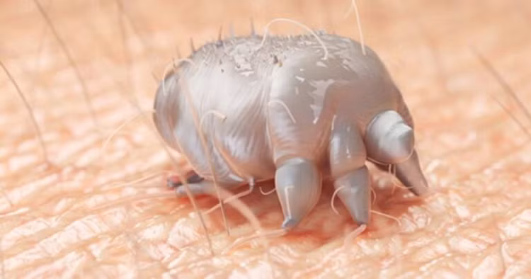 Hình ảnh ký sinh trùng Sarcoptes scabiei (cái ghẻ) - Ảnh BVCC
