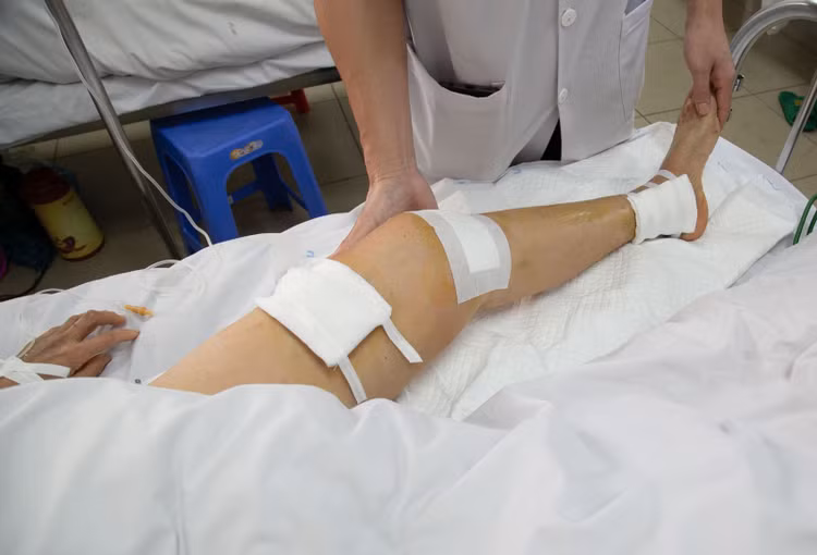 Bác sĩ khoa Chấn thương chỉnh hình hướng dẫn tập phục hồi chức năng chân cho bệnh nhân B.