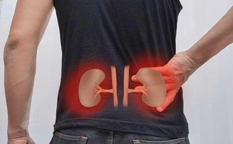 3 vị trí đau cảnh báo bệnh thận cần lưu ý - Hình 8