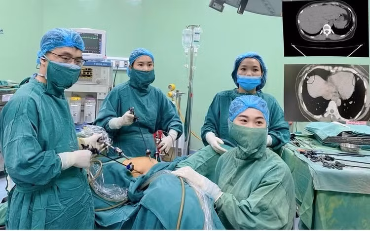 Ca phẫu thuật cho bệnh nhân - Ảnh BVCC Ca phẫu thuật cho bệnh nhân - Ảnh BVCC