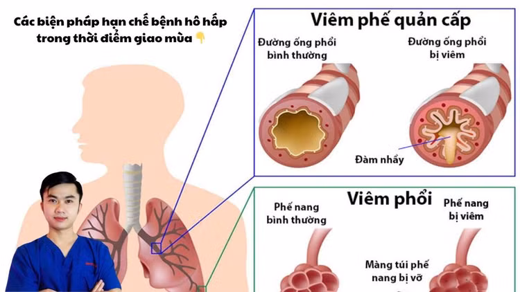 Bệnh dễ gặp trong thời tiết giao mùa - Ảnh BSCC